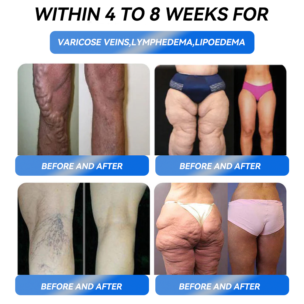 🎁Ourlyard® GLP-1 Pro Weight Loss Oral Solution – Visible results in 7 days, no side effects, suitable for all age groups 🌹🌹