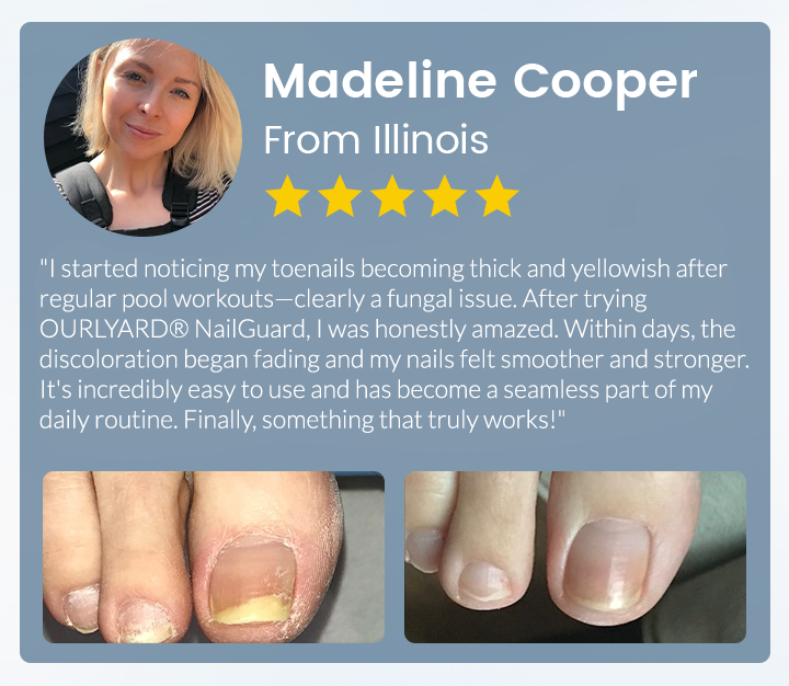 💖Ourlyard® NailGuard Fungal Repair Herbal Spray