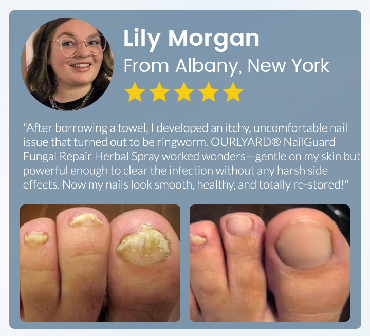 💖Ourlyard® NailGuard Fungal Repair Herbal Spray