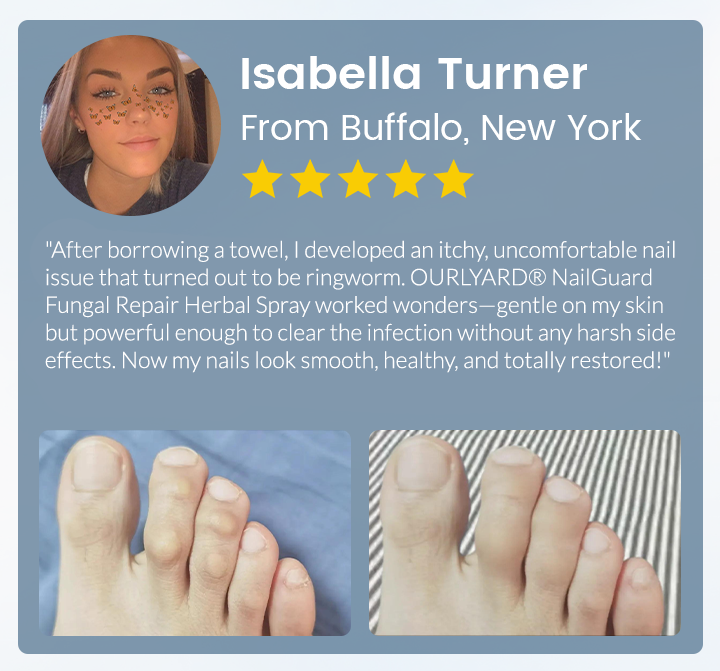 💖Ourlyard® NailGuard Fungal Repair Herbal Spray