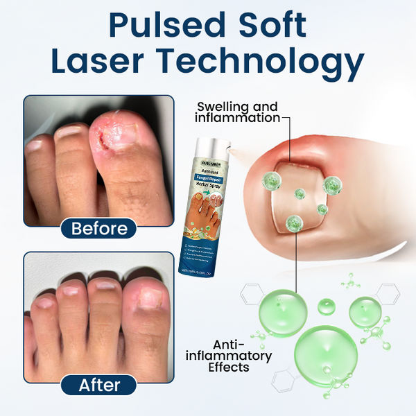 🔥Ourlyard® NailGuard Fungal Repair Herbal Spray