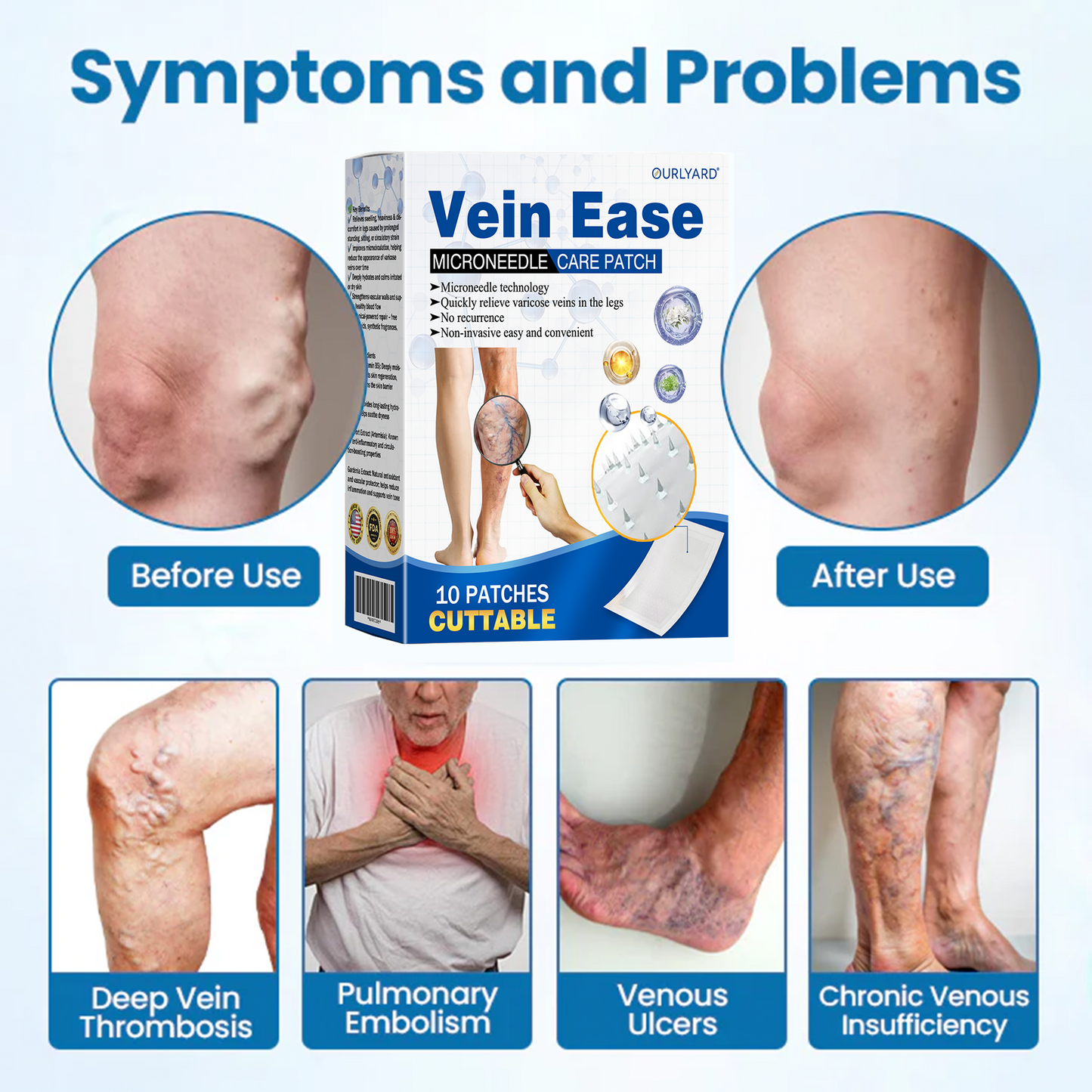 🎁Time-Limited Offer -Ourlyard® Vein Ease Microneedle Care Patch - Cuttable (For Spider Veins, Varicose Veins, Swelling & Leg Fatigue)