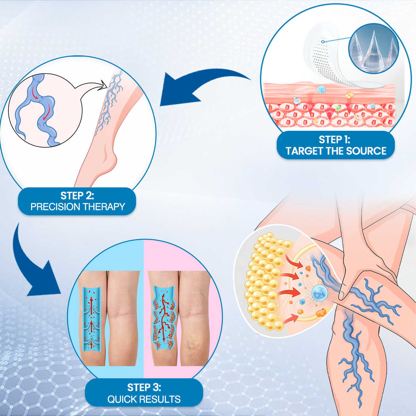 🎁Time-Limited Offer -Ourlyard® Vein Ease Microneedle Care Patch - Cuttable (For Spider Veins, Varicose Veins, Swelling & Leg Fatigue)