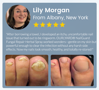 💖Ourlyard® NailGuard Fungal Repair Herbal Spray