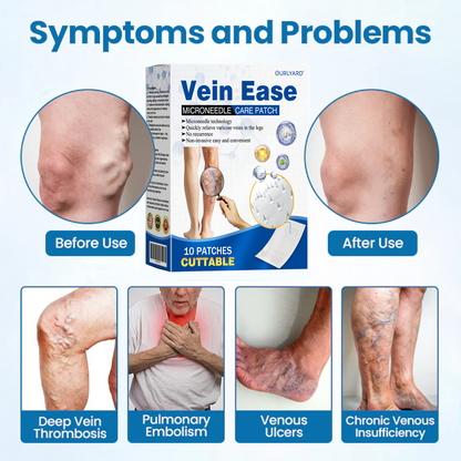 🎁Time-Limited Offer -Ourlyard® Vein Ease Microneedle Care Patch - Cuttable (For Spider Veins, Varicose Veins, Swelling & Leg Fatigue)